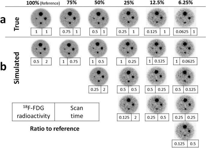 Dose-reduced dedicated breast PET (dbPET) images from 100% down to 6.25% of the standard 18F-FDG dose