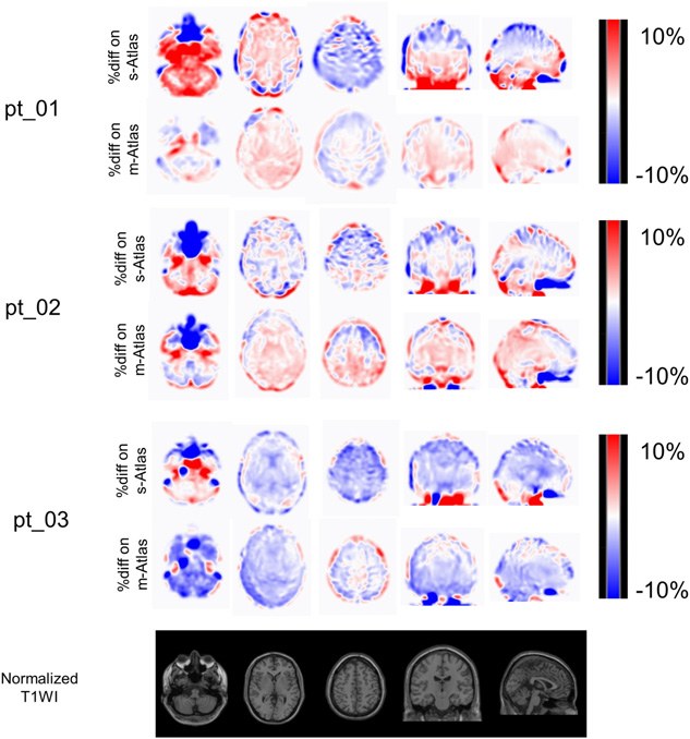 Multi-Atlas-Based Attenuation Correction for Brain 18F-FDG P