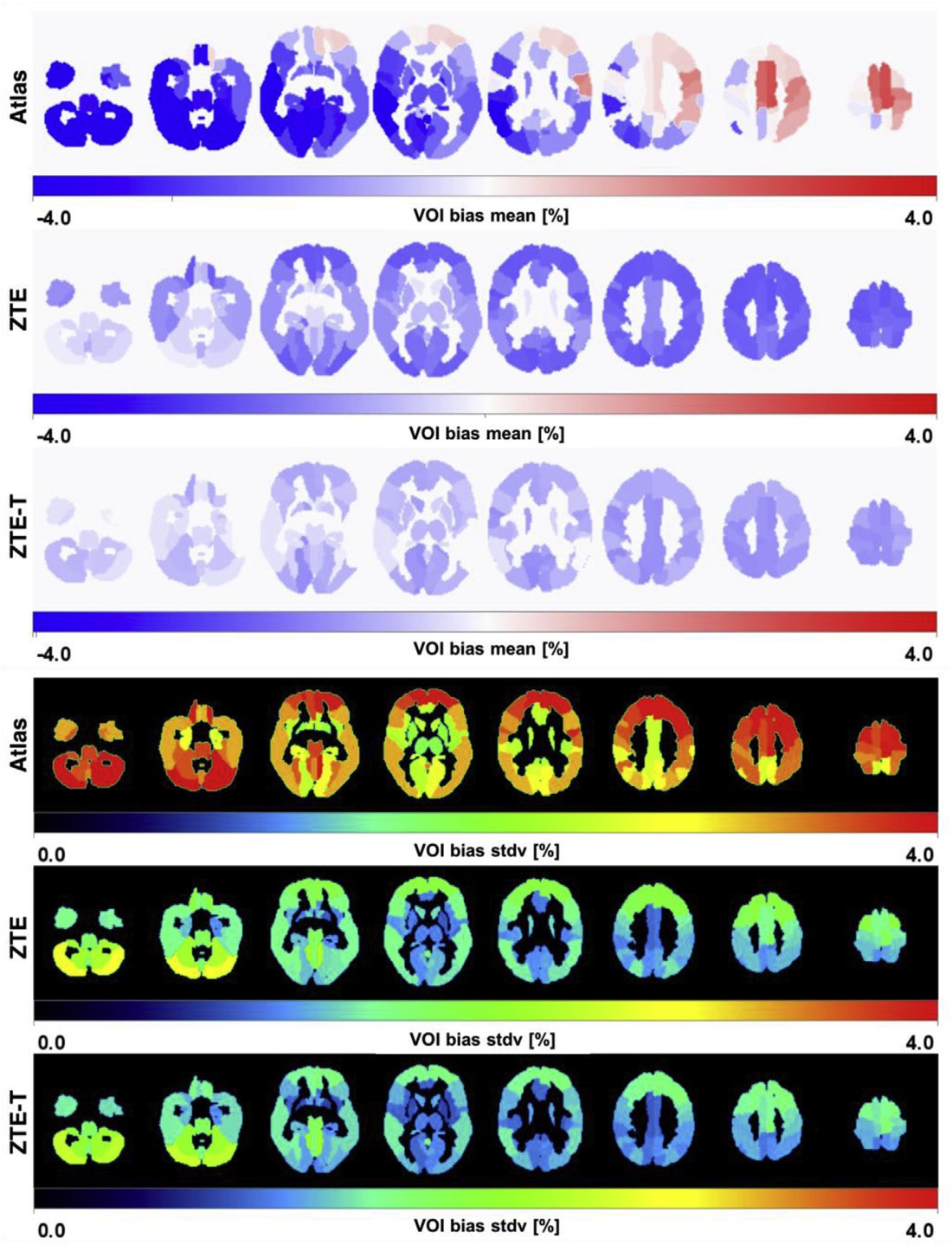Improving PET/MR brain quantitation with template-enhanced Z