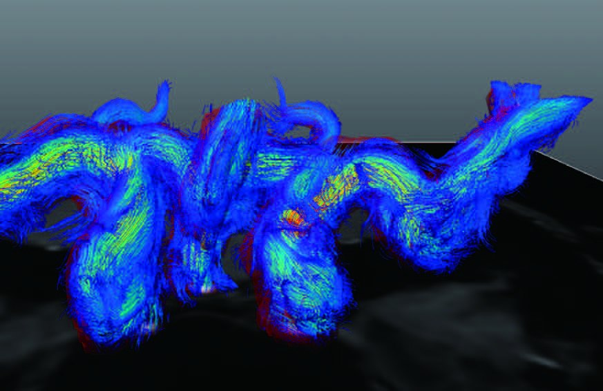 脳4D Flowの高速化